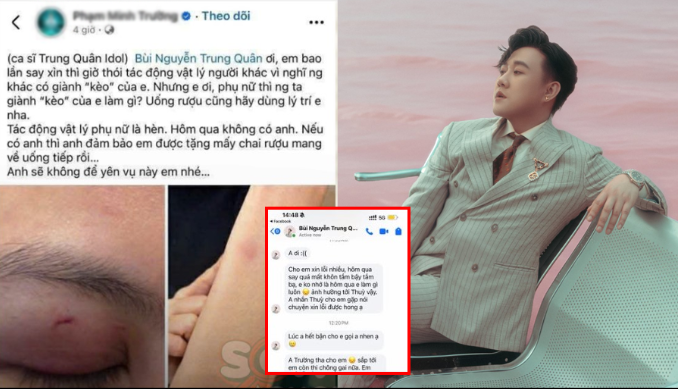 Lộ tin nhắn ca sĩ Trung Quân idol nhắn tin cho chồng cô gái bị anh h:ành h:ung để xin lỗi và mong tha thứ